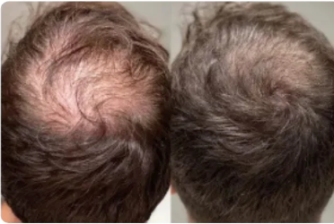 Lossless Shampoo (BA) 2