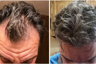 Lossless Shampoo (HR) 4