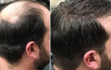 Lossless Shampoo (HR) 6