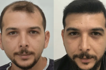 Lossless Shampoo (BA) 8